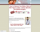 moleswartsremoval.com – moleswartsremoval Resources and Information.